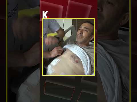 Bağırsak kanseri tedavisi için gitti, organlarının ters yerde olduğunu öğrendi #shorts