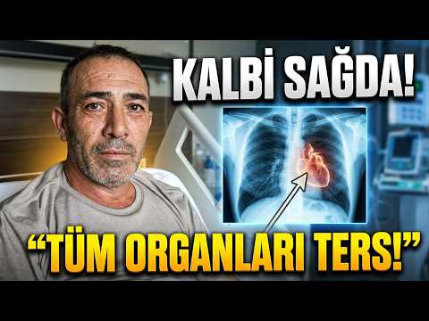 Tüm organları ters yerde İHA